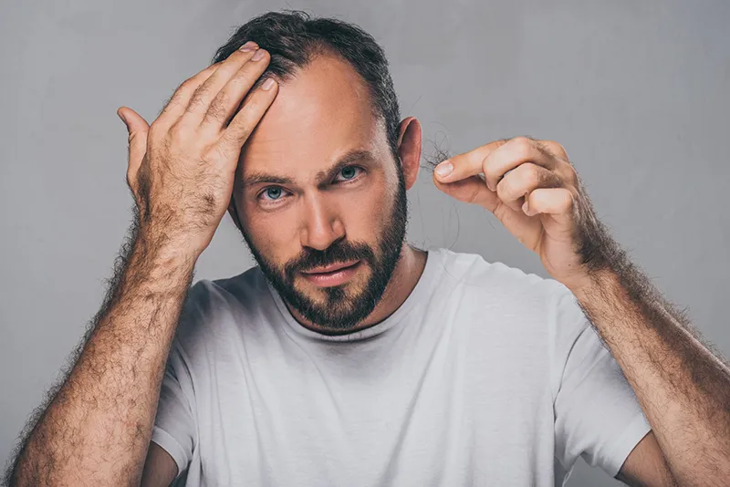 man noticing hair loss